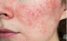 Skin Care Products