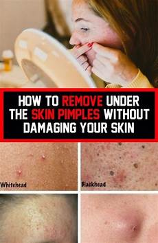 Skin Care Products