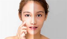 Skin Whitening