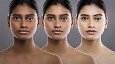 Skin Whitening