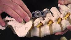 Spinal implant