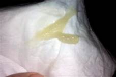 Sticky