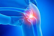Tibial Stem
