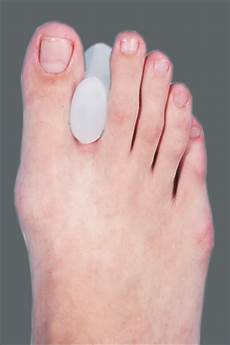Toe Separator