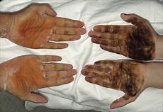 Treatment Chemical