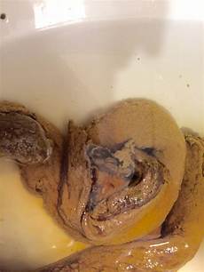 Worms